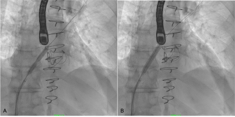 QITip February 2023 Figure 4